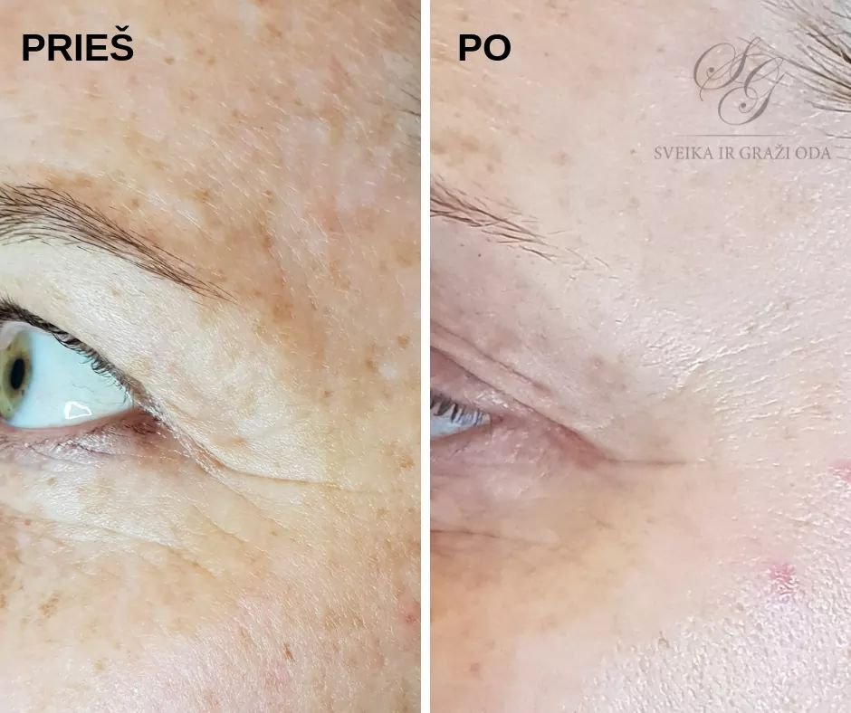 Vestuvinės šukuosenos, grožio procedūros, soliariumai Kosmetologo paslaugos visai šeimai