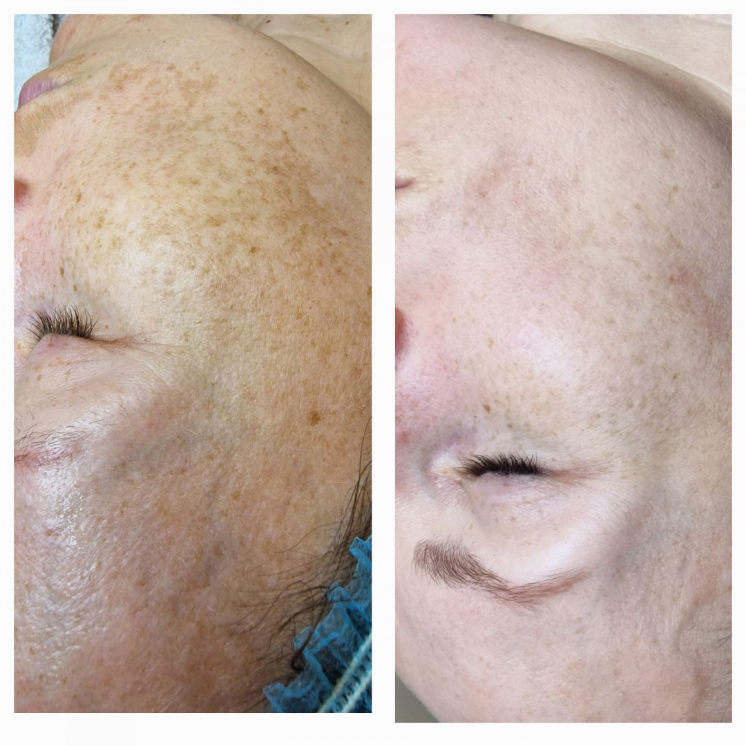 Kosmetologo paslaugos visai šeimai